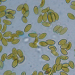 Serpula lacrymans spores