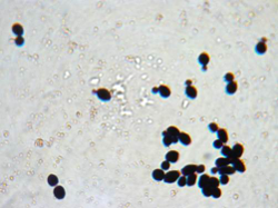 Yeast